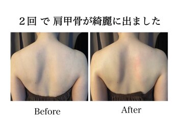 ナチュラーレ 天王寺店(Naturale)/痩身リンパマッサージ二の腕美脚