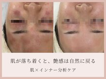 サロン ド ボーテ シャルル(Chaleureux)の雰囲気（インナーカウンセリング有）