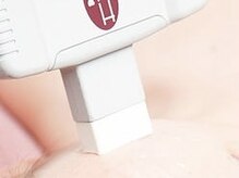 シュクル(SUCRE)/うなじも光脱毛で