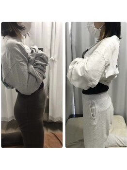 くまがい整体院 若松店/骨盤矯正+EMS+食事指導
