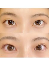 レッドモート(Red moat)/ダブルアイリフト