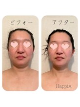 ハピア(HappiA)/小顔コルギ