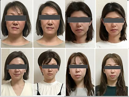 フィシスの写真