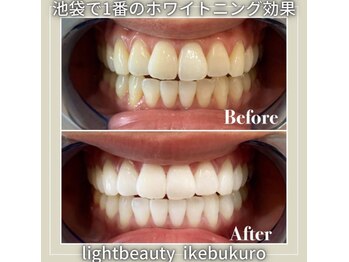 ライトビューティー 池袋店(LightBeauty)/症例写真
