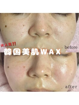 プルティティア(Pultitia)/