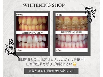 ホワイトニングショップ 大和八木店