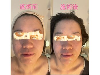 リオズ(RIO'S)/お客さん小顔前後比べ写真