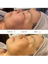 ビーエヌ エステティックアンドスパ(BN Esthetic&Spa)/60代ムルトクス