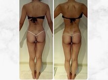 ナチュラーレ 京都四条烏丸店(Naturale)/リンパマッサージ痩身ダイエット