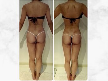 ナチュラーレ 京都四条烏丸店(Naturale)/リンパマッサージ痩身ダイエット