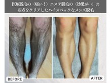 レジェンド 鹿児島店の雰囲気（「ツルツルor量を減らして自然な毛量に」お好みの仕上がりを♪）