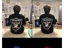 ストレチックス 近江八幡店/肩痛改善ビフォーアフター1回