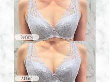 個室の完全予約制。痩せ型の方もバストアップ可能です。