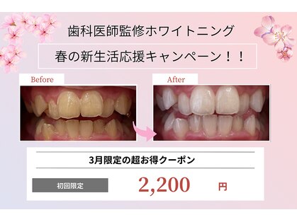 ホワイトニングショップ 津店の写真