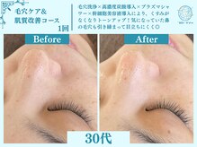 フローフシ∞/【毛穴洗浄】毛穴の詰まり改善