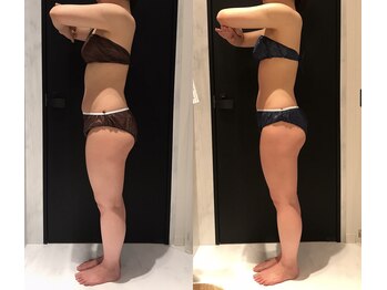 リボディ 表参道(An re Body)/before→after