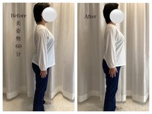 ワン ストレッチ(ONE stretch)/美姿勢30代女性before・after