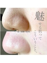 アーフ(ARF)/肌質改善