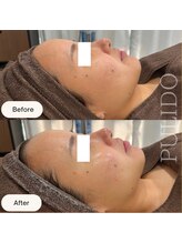 プリドー(PULIDO)/フォーエバーヤング