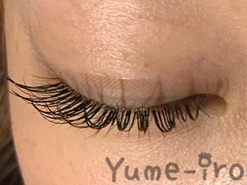 ユメイロ(Yume-iro)/初回クーポン100本￥6400