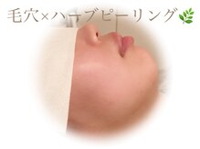 ソワン(soin)