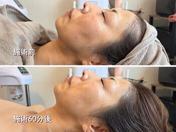 オラ(Ola)/40代/60分後