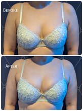 ククナ 上越店(KUKUNA)/30代（１回目）