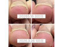 ブロックファイブハナ(Block 5 HANA)の雰囲気(手・足の爪ケア、巻き爪もご相談下さい♪)