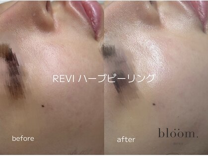 ブルーム(bloom.)の写真