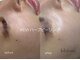 ブルーム(bloom.)の写真