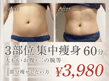 プリオール 前橋南店(Prior)の写真/太もも・お腹・二の腕等集中!痩身マシン+熟練ハンド60分で理想のラインを目指す☆