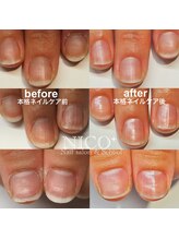 ニコプラス(NICO+)/ジェルネイルができない方向け