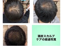 パセリ(PaSeRy)/頭皮スカルプケア