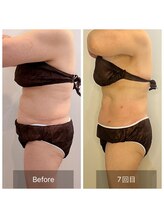 ウィズ ユー ビューティ(with U beauty)/一目瞭然の変化！！