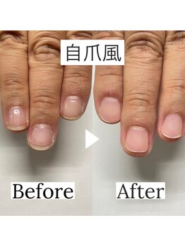 ヒューマン鍼灸接骨院/プロテクションネイル/仕上がり