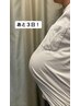 【産前のツライ腰痛肩こりに】(来院２回目の方限定)マタニティ整体￥3,980