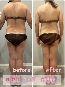 サロン ド フェイス モアナ(Salon de Faith Moana)/ハイブリットダイエット【50代】