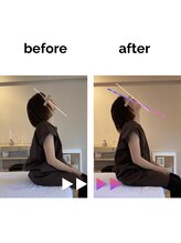 フィデル(fidele)/首肩こりがスッキリ可動域アップ