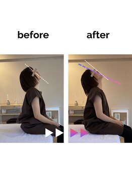 フィデル(fidele)/首肩こりがスッキリ可動域アップ