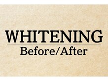 キラット 越谷レイクタウン店(Kiratt)/