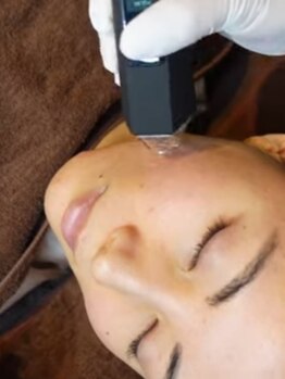 エクラの写真/【肌荒れ改善】ダーマを超えた新メニュー!プラズマエネルギーで褒められ肌☆まずはお試しから¥15400→¥8800