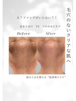 プロラボスパ 岡山店/つるつる毛穴