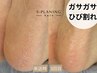 【残り2名】ガサガサ・ひび割れかかとに悩む方/素足に自信が持てるフットケア