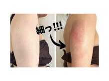 ルミナス/二の腕スッキリ！美ラインへ♪