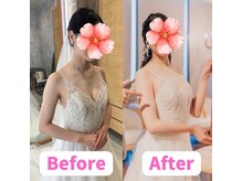 すずも整骨院 整体院/「肩の高さ」違っていませんか？