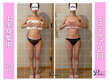 プルクレ 常磐町店(Pulchre)/20代上半身集中♪