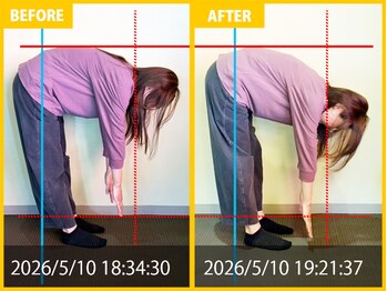 整体院 元 光の森店/腰痛改善で前屈もスムーズに改善
