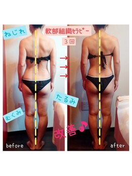 ビューティサロン キヨの部屋(beauty salon)/【軟部組織セラピー】　３回