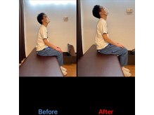 やぎはし整体院 柏駅東口店/姿勢ビフォーアフター
