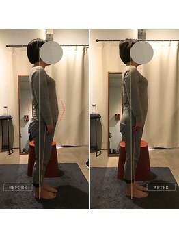 岡山整体 リソル(Resol)/反り腰｜ぽっこりお腹の変化